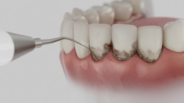Reliable Tooth Extraction contractor in Greene, RI by Smile Center Dentistry